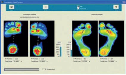 اشعه ایکس, سی تی اسکن و تصاویر سه بعدی در تولید کفش